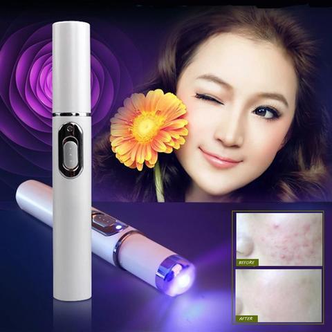 Blue Light Therapy Acne Laser Pen – Scar and Wrinkle Removal Device for Skin Care - FlexFinds